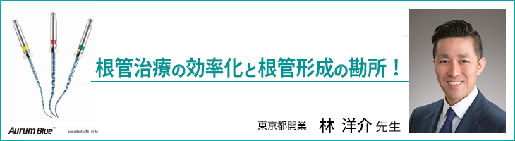 根管治療の効率化と根管形成の勘所！