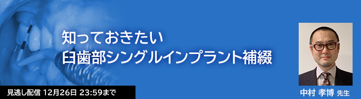 知っておきたい臼歯部シングルインプラント補綴