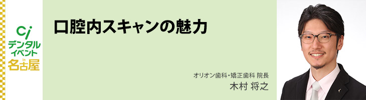 口腔内スキャンの魅力